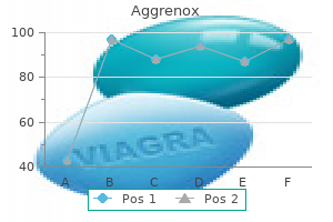 buy aggrenox caps 25/200 mg on line