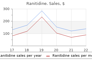 buy ranitidine 150 mg low price