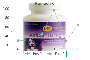 purchase ranitidine 150mg with visa