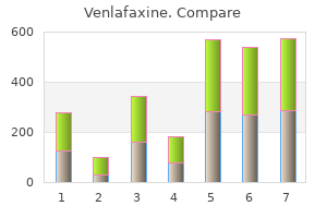 purchase venlafaxine 150mg on-line