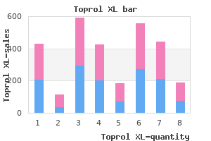 buy toprol xl 100 mg with visa