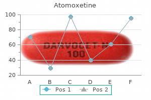 purchase atomoxetine 25 mg with amex