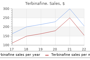 buy 250 mg terbinafine visa