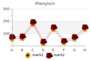 best 100 mg phenytoin