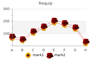 buy generic requip 2mg on line