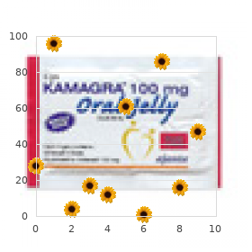 Cleft palate stapes fixation oligodontia