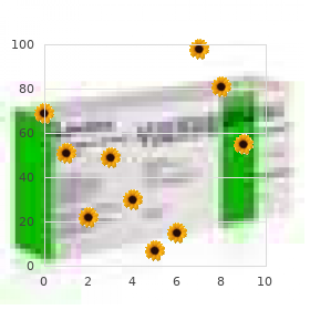 Dimitri Sturge Weber syndrome
