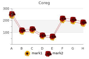 buy 25 mg coreg visa