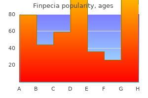 cheap 1 mg finpecia