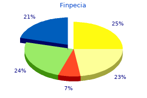 generic finpecia 1 mg mastercard