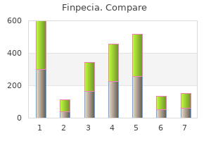 buy finpecia 1 mg with mastercard