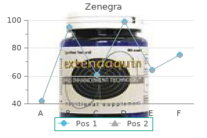 order zenegra 100 mg amex