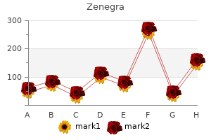 order zenegra 100mg line