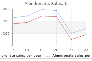 trusted alendronate 35mg