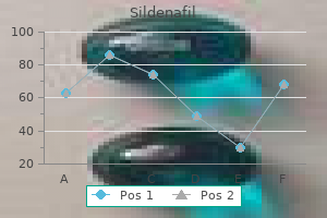 buy sildenafil 75mg line