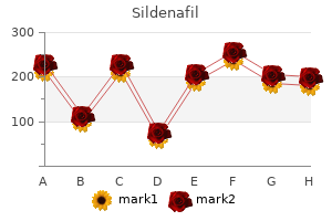 order 25mg sildenafil amex