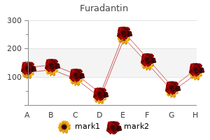 purchase furadantin 50mg on-line