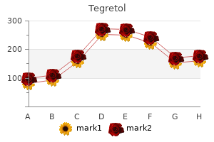 order tegretol 100mg amex