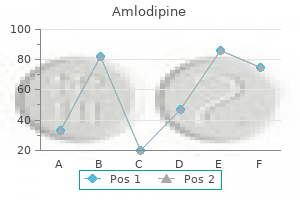 buy amlodipine 10mg overnight delivery