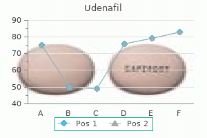 cheap udenafil 100 mg with visa