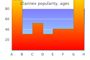 order 5 mg clarinex